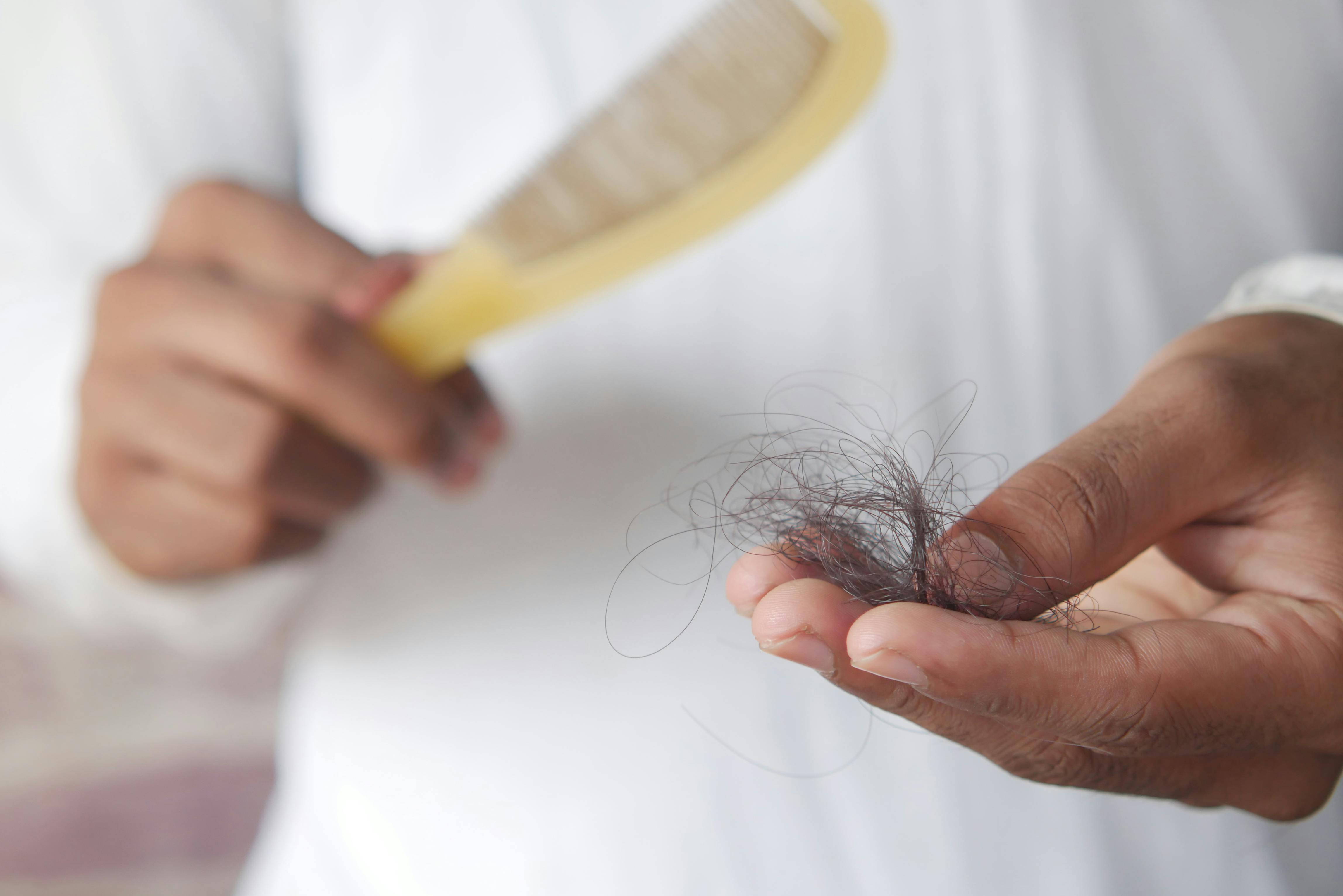 competition image for Crack the code of hairloss